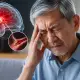 Stroke Bisa Datang Tanpa Peringatan, Kenali Gejala Awal, Penyebab, dan Cara Mencegahnya Sejak Dini